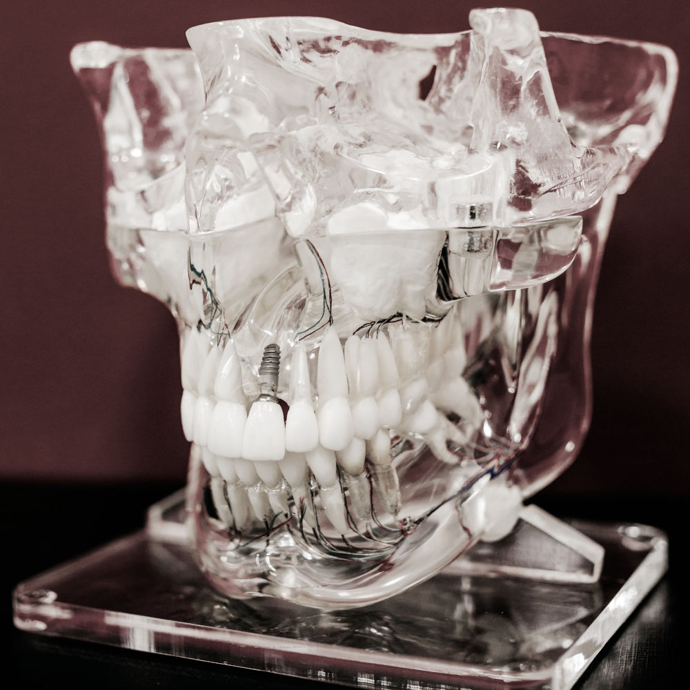 Implantologie Zahnarzt Windach